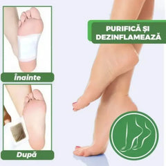 Set 50 Plasturi Detoxifianți Kinoki pentru Tălpi cu Turmalină, Vitamina C și E